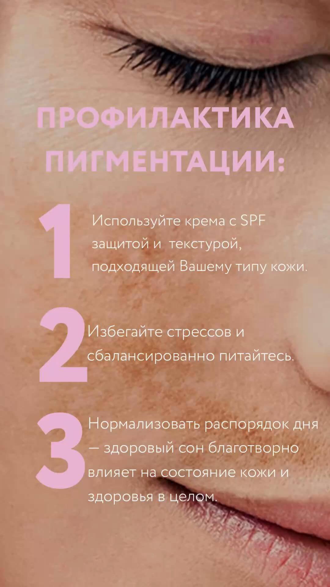 Профилактика пигментации